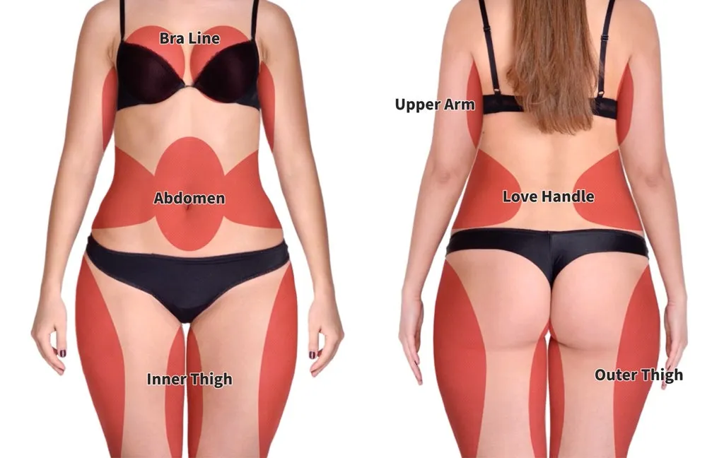 Tightsculpting | Body Sculpting Laser | Andromeda Medspa