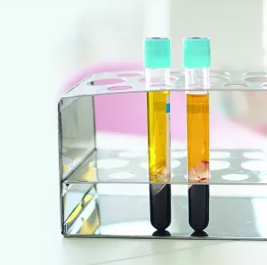 Prp | Andromeda Medspa