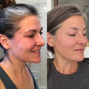 1691785269__artemis-led-mask-before-after2__original