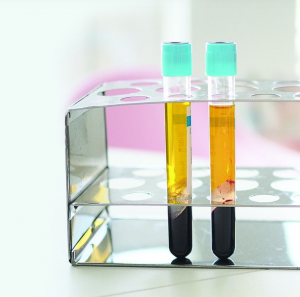 Prp Tubes | Hair Restoration | Andromeda Medspa