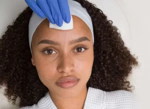 Chemical Peel | Andromeda Medspa | Buford Ga